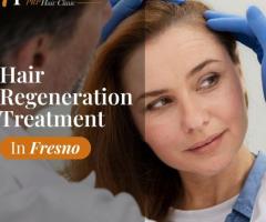 Hair Regeneration Treatment in Fresno