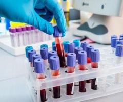 Medical laboratory in Bronx NY | BIO-CARE SERVICES INC - Image 3